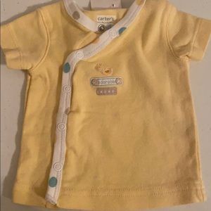 NB yellow button up shirt